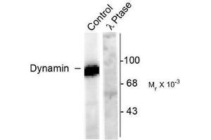 Image no. 1 for anti-Dynamin 1 (DNM1) (pSer778) antibody (ABIN372617) (Dynamin 1 Antikörper  (pSer778))