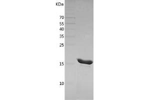 Western Blotting (WB) image for Tumor Necrosis Factor alpha (TNF alpha) (AA 80-234) protein (His tag) (ABIN7125536)
