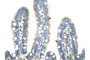 APCS antibody was used for immunohistochemistry at a concentration of 4-8 ug/ml to stain Epithelial cells of intestinal villus (arrows) in Human Intestine. (APCS Antikörper  (N-Term))