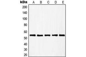 Western blot analysis of RAD23B expression in A431 (A), HuvEc (B), HEK293 (C), HeLa (D), HT29 (E) whole cell lysates. (RAD23B Antikörper  (N-Term))
