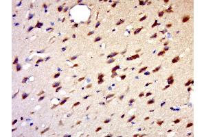 Paraformaldehyde-fixed, paraffin embedded rat brain, Antigen retrieval by boiling in sodium citrate buffer (pH6. (HENMT1 Antikörper  (AA 1-100))