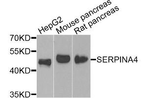 Western blot analysis of extracts of various cell lines, using SERPINA4 antibody (ABIN4905121) at 1:1000 dilution. (SERPINA4 Antikörper)