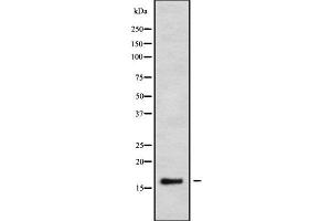 Western blot analysis of CALML3 using K562 whole cell lysates (CALML3 Antikörper  (Internal Region))