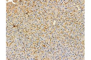 ABIN7095992 and ABIN7100054 at 1/100 staining mouse liver tissue by IHC-P. (SNAP47 Antikörper)
