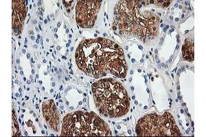 Immunohistochemical staining of paraffin-embedded Human Kidney tissue using anti-ACY1 mouse monoclonal antibody. (Aminoacylase 1 Antikörper)