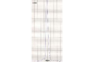product purity: gel permeation chromatography (Superose 12/HR) (Maus anti-Human IgE Antikörper (Biotin))