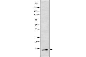 Western blot analysis of MED11 using RAW264. (MED11 Antikörper  (Internal Region))