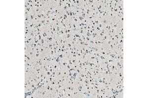 IHC analysis of SNRPD2 using anti-SNRPD2 antibody (ABIN7598963).