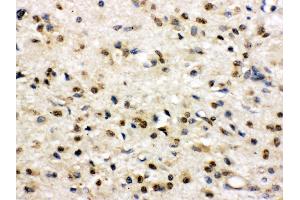 Immunohistochemistry (Paraffin-embedded Sections) (IHC (p)) image for anti-Discs, Large Homolog 4 (Drosophila) (DLG4) (AA 581-724) antibody (ABIN3043563) (DLG4 Antikörper  (AA 581-724))