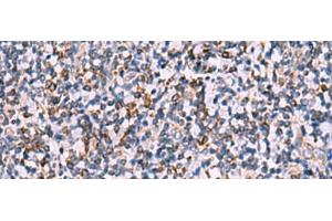 Immunohistochemistry of paraffin-embedded Human tonsil tissue using IPPK Polyclonal Antibody at dilution of 1:30(x200) (IPPK Antikörper)