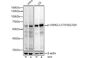 Western blot analysis of extracts of various cell lines, using Phospho-V-S79/S82/S84 Rabbit mAb antibody (ABIN7271290) at 1:1000 dilution.