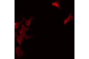 ABIN6277300 staining NIH-3T3 by IF/ICC. (NDUFS1 Antikörper  (N-Term))