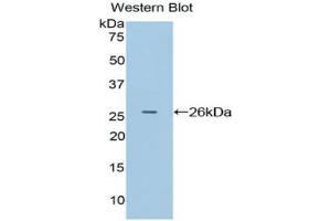 Western blot analysis of the recombinant protein. (APC Antikörper  (AA 2634-2842))