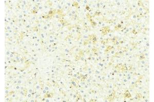 ABIN6274966 at 1/100 staining Mouse liver tissue by IHC-P.
