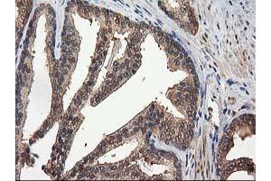 Image no. 12 for anti-Destrin (Actin Depolymerizing Factor) (DSTN) antibody (ABIN1497910) (Destrin Antikörper)