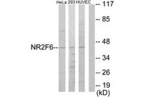Western blot analysis of extracts from HeLa/HuvEc/293 cells, using NR2F6 Antibody. (NR2F6 Antikörper  (AA 11-60))