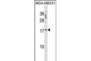 PTRH2 Antibody (N-term) (ABIN1881706 and ABIN2839089) western blot analysis in MDA-M cell line lysates (35 μg/lane). (PTRH2 Antikörper  (N-Term))