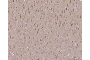 IHC analysis of MFF using anti-MFF antibody (ABIN7599292).