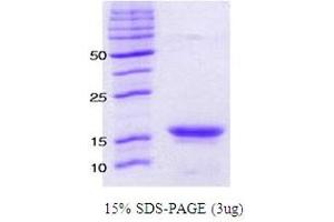 Figure annotation denotes ug of protein loaded and % gel used. (alpha Synuclein A53T (active) Protein)