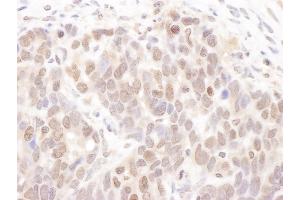 Immunohistochemistry (IHC) image for anti-Casein Kinase 2 alpha 1 (CSNK2A1) (C-Term) antibody (ABIN7453947) (CSNK2A1/CK II alpha Antikörper  (C-Term))