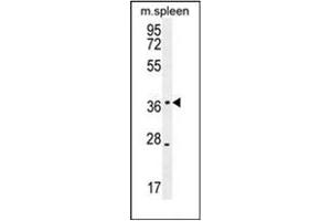 Western blot analysis of KLHDC1 Antibody (N-term) in mouse spleen tissue lysates (35ug/lane). (KLHDC1 Antikörper  (N-Term))