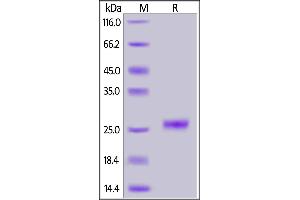 SDS-PAGE (SDS) image for Interleukin 33 (IL33) (AA 109-270) (Active) protein (His tag) (ABIN7013460)