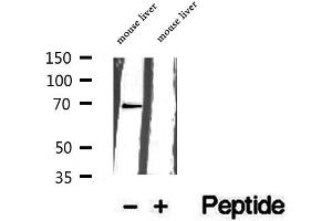 Western blot analysis of extracts of mouse liver tissue, using GPD2 antibody. (GPD2 Antikörper  (N-Term))