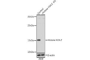 Western blot analysis of extracts from normal (control) and Histone H2A. (Histone H2A Antikörper  (AA 1-128))