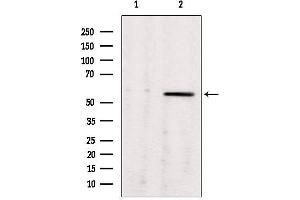 Western blot analysis of extracts from rat brain, using ALDH7A1 antibody. (ALDH7A1 Antikörper  (C-Term))