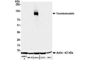 Western Blotting (WB) image for anti-Thrombomodulin (THBD) (AA 17-517) antibody (ABIN7795654)