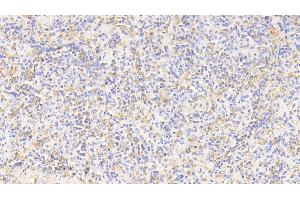Immunohistochemistry (IHC) image for anti-Hemoglobin antibody (ABIN7437236)