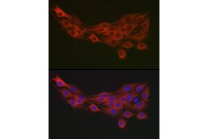 Immunofluorescence analysis of PC-12 cells using PDK1/PDHK1 Rabbit pAb (ABIN3015351, ABIN3015352, ABIN1681301, ABIN5663787 and ABIN6214001) at dilution of 1:100 (40x lens). (PDPK1 Antikörper  (AA 1-150))