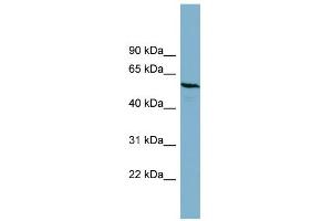 WB Suggested Anti-PGM3 Antibody Titration: 0. (Phosphoglucomutase 3 Antikörper  (Middle Region))