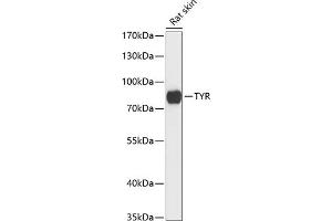 Western blot analysis of extracts of rat skin, using TYR antibody (ABIN6132743, ABIN6149746, ABIN6149747 and ABIN6217672) at 1:3000 dilution. (TYR Antikörper  (AA 20-340))