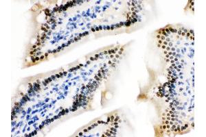 Immunohistochemistry (Paraffin-embedded Sections) (IHC (p)) image for anti-Zinc Finger and BTB Domain Containing 7A (ZBTB7A) (AA 125-163), (N-Term) antibody (ABIN3044569)