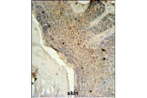 MFSD3 Antibody (Center) (ABIN651438 and ABIN2840241) IHC analysis in formalin fixed and paraffin embedded human skin tissue followed by peroxidase conjugation of the secondary antibody and DAB staining. (MFSD3 Antikörper  (AA 174-202))