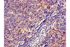 Immunohistochemistry of paraffin-embedded human lymph node tissue using ABIN7155597 at dilution of 1:100 (HLA-DQB1 Antikörper  (AA 128-175))