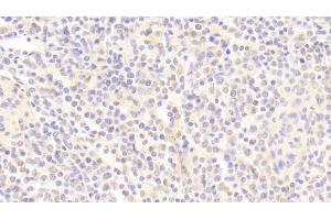 Immunohistochemistry (IHC) image for anti-Amyloid beta (A4) Precursor Protein-Binding, Family B, Member 1 Interacting Protein (APBB1IP) (AA 188-421) antibody (ABIN7443662)