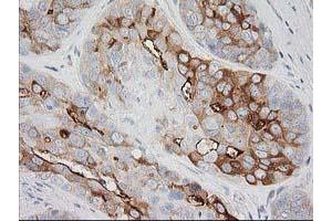 Image no. 1 for anti-BAI1-Associated Protein 2 (BAIAP2) antibody (ABIN1496805) (BAIAP2 Antikörper)