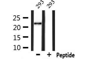 Western blot analysis of extracts from 293, using GPX4 Antibody.