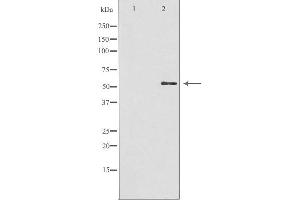 Western blot analysis of extracts from HuvEc cells, using GBA3 antibody. (GBA3 Antikörper  (Internal Region))