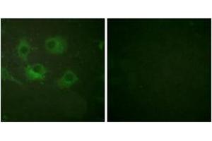 Immunofluorescence analysis of HuvEc cells, using Claudin 3 Antibody. (Claudin 3 Antikörper  (AA 171-220))