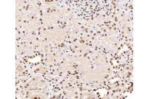 ABIN6267406 at 1/200 staining human kidney tissue sections by IHC-P. (Stathmin 1 Antikörper  (pSer38))