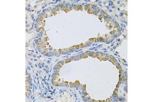 Immunohistochemistry of paraffin-embedded mouse lung using AP2B1 Antibody (ABIN1871002) at dilution of 1:100 (40x lens). (AP2B1 Antikörper)