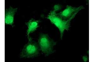 Immunofluorescence (IF) image for anti-Cyclin-Dependent Kinase 2 (CDK2) antibody (ABIN1497400) (CDK2 Antikörper)