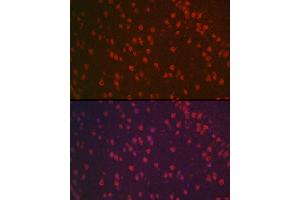 Immunofluorescence analysis of mouse brain using [KO Validated] NeuN Rabbit pAb (ABIN3021158, ABIN3021159, ABIN1513254, ABIN1514400 and ABIN6214040) at dilution of 1:100 (40x lens). (NeuN Antikörper  (AA 1-220))