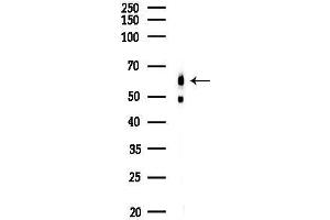 anti-Phosphoinositide 3 Kinase, p85 alpha (PI3K p85a) (C-Term) antibody