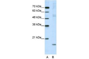 WB Suggested Anti-NIP7 Antibody Titration:  5. (NIP7 Antikörper  (C-Term))