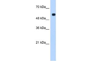 WB Suggested Anti-PUF60 Antibody  Titration: 1. (PUF60 Antikörper  (C-Term))