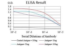 Black line: Control Antigen (100 ng), Purple line: Antigen(10 ng), Blue line: Antigen (50 ng), Red line: Antigen (100 ng), (SYCP3 Antikörper  (AA 27-128))